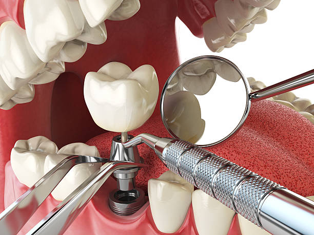 Best Emergency Root Canal Treatment in Maple Heights, OH